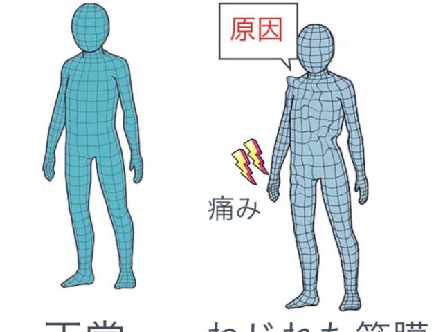 整骨院と整体の違いとは？整形外科との使い分け・健康保険が使える範囲を新小岩から解説